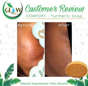 Comfort Turmeric Soap 3 Pack Glow H&B Essentials - Image 3