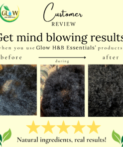 Alternative view of Rapid Hair Growth Stimulating Serum (1oz)